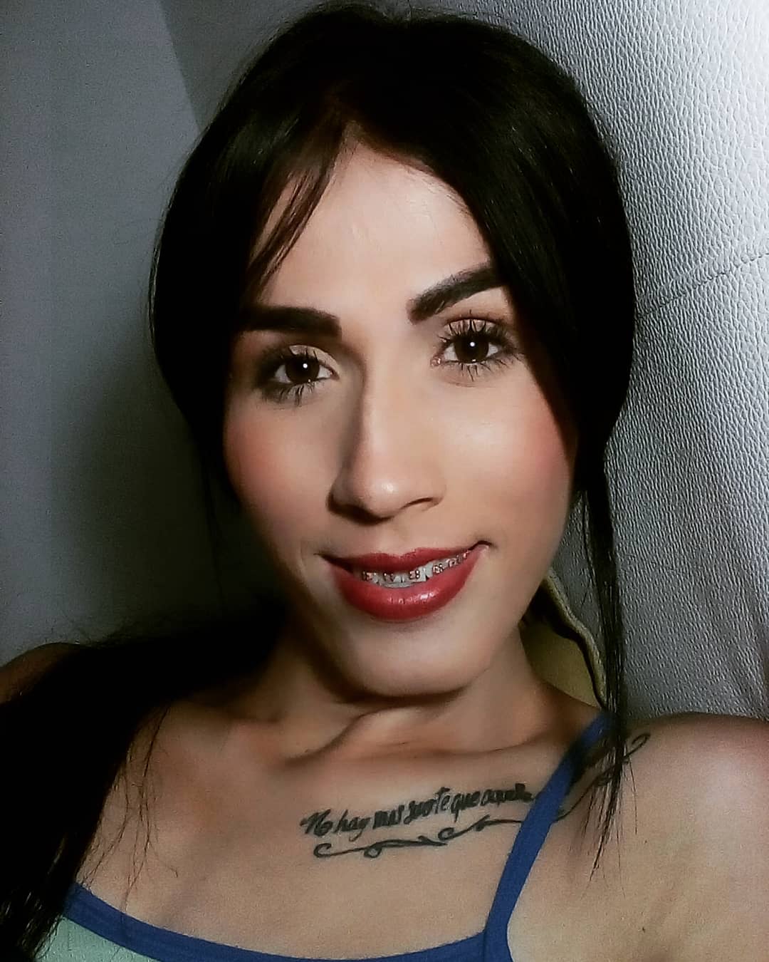 Trans Allyson Rojas braces smile
