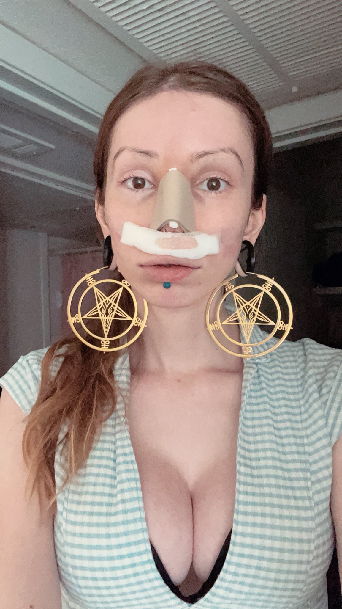 Emily Snow TS nose job selfies.